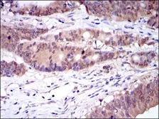 Anti-Caspase 8 antibody [1H11] used in IHC (Paraffin sections) (IHC-P). GTX60510