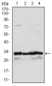 Anti-NQO1 antibody [1A11] used in Western Blot (WB). GTX60524