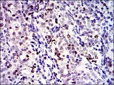 Anti-Survivin antibody [1H5] used in IHC (Paraffin sections) (IHC-P). GTX60534