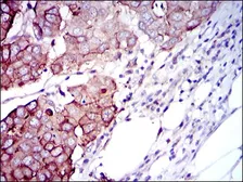 Anti-p70 S6K antibody [5G9] used in IHC (Paraffin sections) (IHC-P). GTX60550