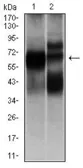 Anti-HEXA antibody [3F10] used in Western Blot (WB). GTX60574