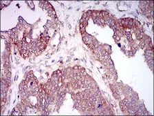 Anti-HAS2 antibody [4E7] used in IHC (Paraffin sections) (IHC-P). GTX60647