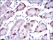 Anti-SLC27A5 antibody [4B11C10] used in IHC (Paraffin sections) (IHC-P). GTX60693