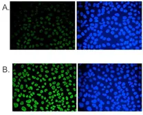 Anti-5-Methylcytosine / 5-mC antibody [GT9076] used in Immunocytochemistry/ Immunofluorescence (ICC/IF). GTX60803