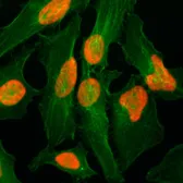Anti-Histone H2A.Z antibody [RM215] used in Immunocytochemistry/ Immunofluorescence (ICC/IF). GTX60915
