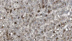 Anti-Vitronectin antibody [HV2] used in IHC (Paraffin sections) (IHC-P). GTX60980
