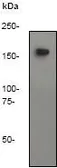 Anti-CD45 antibody [Y321] used in Western Blot (WB). GTX61210
