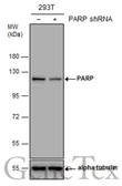 Anti-PARP antibody [GT6212] used in Western Blot (WB). GTX628836