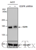 Anti-EGFR antibody [GT461] used in Western Blot (WB). GTX628888