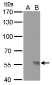 Anti-Influenza A virus H1N1 NA (Neuraminidase) antibody [GT172] used in Western Blot (WB). GTX629695