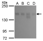 Anti-KDM6A antibody [GT1612] used in Western Blot (WB). GTX630412