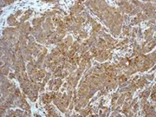 Anti-Caspase 8 antibody [EPR162] used in IHC (Paraffin sections) (IHC-P). GTX63075