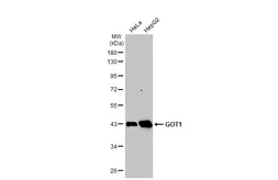 Anti-GOT1 antibody [GT1342] used in Western Blot (WB). GTX632032