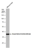 Anti-GOT1 antibody [GT1255] used in Western Blot (WB). GTX632033