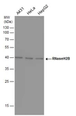 Anti-RNaseH2B antibody [GT419] used in Western Blot (WB). GTX632043