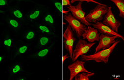 Anti-RNaseH2B antibody [GT479] used in Immunocytochemistry/ Immunofluorescence (ICC/IF). GTX632044