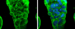Anti-Glypican-3 antibody [GT2473] used in Immunocytochemistry/ Immunofluorescence (ICC/IF). GTX633410