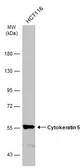 Anti-Cytokeratin 5 antibody [GT1486] used in Western Blot (WB). GTX634308
