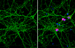 Anti-VAMP2 antibody [GT6311] used in Immunocytochemistry/ Immunofluorescence (ICC/IF). GTX634812