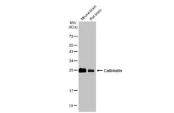 Anti-Calbindin antibody [GT386] used in Western Blot (WB). GTX634833