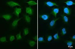 Anti-GSK3 beta antibody [GT16711] used in Immunocytochemistry/ Immunofluorescence (ICC/IF). GTX635816
