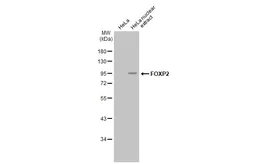 Anti-FOXP2 antibody [GT12812] used in Western Blot (WB). GTX635965