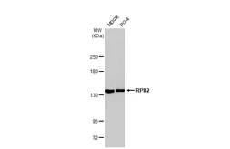 Anti-RPB2 antibody [HL1043] used in Western Blot (WB). GTX635977