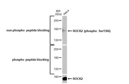 Anti-ROCK2 (phospho Ser1366) antibody [HL1071] used in Western Blot (WB). GTX636103