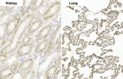 Anti-PARP14 antibody [HL1180] used in IHC (Paraffin sections) (IHC-P). GTX636485