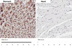 Anti-E-Cadherin antibody [HL1228] used in IHC (Paraffin sections) (IHC-P). GTX636576