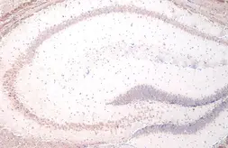 Anti-YTHDF2 antibody [HL1354] used in IHC (Paraffin sections) (IHC-P). GTX636774