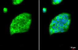 Anti-Fibrinogen gamma antibody [HL1395] used in Immunocytochemistry/ Immunofluorescence (ICC/IF). GTX636835