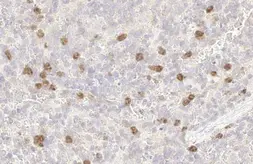 Anti-p53R2 antibody [HL1400] used in IHC (Paraffin sections) (IHC-P). GTX636840