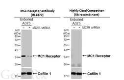 Anti-MC1 Receptor antibody [HL1470] used in Western Blot (WB). GTX636944