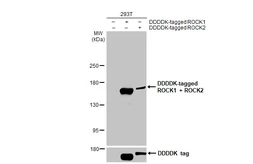 Anti-ROCK1 + ROCK2 antibody [HL1632] used in Western Blot (WB). GTX637125