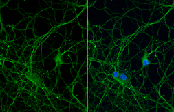 Anti-beta Tubulin 3/ Tuj1 antibody [HL1708] used in Immunocytochemistry/ Immunofluorescence (ICC/IF). GTX637307