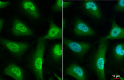 Anti-Nurr1 antibody [HL1852] used in Immunocytochemistry/ Immunofluorescence (ICC/IF). GTX637577