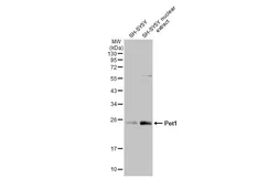 Anti-Pet1 antibody [HL2043] used in Western Blot (WB). GTX637944
