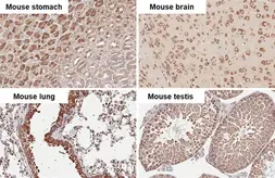Anti-RPLP2 antibody [HL2256] used in IHC (Paraffin sections) (IHC-P). GTX638308