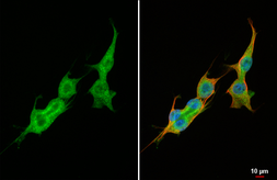 Anti-VEGFC antibody [HL2289] used in Immunocytochemistry/ Immunofluorescence (ICC/IF). GTX638344