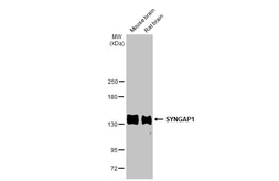 Anti-SYNGAP1 antibody [HL2292] used in Western Blot (WB). GTX638347