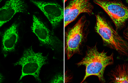 Anti-RPL32 antibody [HL2329] used in Immunocytochemistry/ Immunofluorescence (ICC/IF). GTX638492