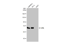 Anti-tPA antibody [HL2585] used in Western Blot (WB). GTX639036