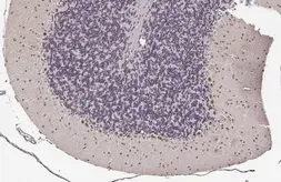Anti-LIM1 antibody [HL2774] used in IHC (Paraffin sections) (IHC-P). GTX639639