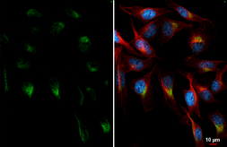 Anti-PCSK9 antibody [HL2814] used in Immunocytochemistry/ Immunofluorescence (ICC/IF). GTX639955