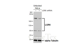Anti-LGR6 antibody [HL2827] used in Western Blot (WB). GTX640098