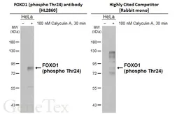 Anti-FOXO1 (phospho Thr24) antibody [HL2860] used in Western Blot (WB). GTX640131