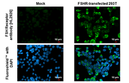 Anti-FSH Receptor antibody [HL2926] used in Immunocytochemistry/ Immunofluorescence (ICC/IF). GTX640269