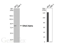 Anti-ENaC Alpha antibody [HL2967] used in Western Blot (WB). GTX640354