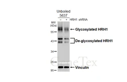 Anti-HRH1 antibody [HL3037] used in Western Blot (WB). GTX640475